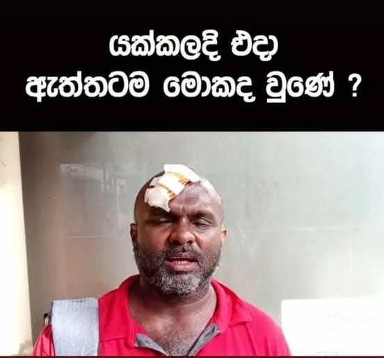 යක්කල සිද්ධියේ ඇත්ත මෙන්න..!