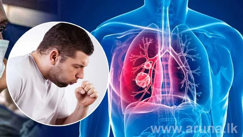 ක්ෂය රෝගීන් වැඩිම පිරිස බස්නාහිරින්